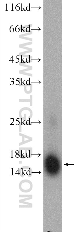 Western Blot (WB) analysis of human brain tissue using RBP1 Polyclonal antibody (22683-1-AP)