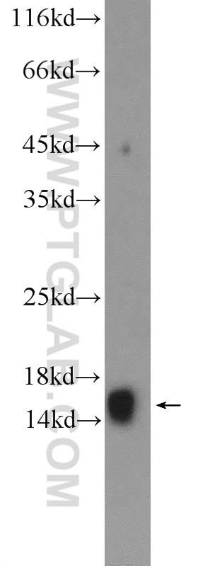 Western Blot (WB) analysis of human liver tissue using RBP1 Polyclonal antibody (22683-1-AP)