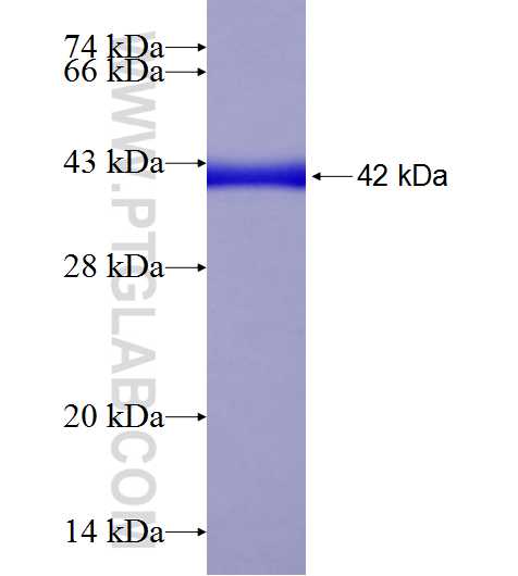 RBP1 fusion protein Ag18572 SDS-PAGE