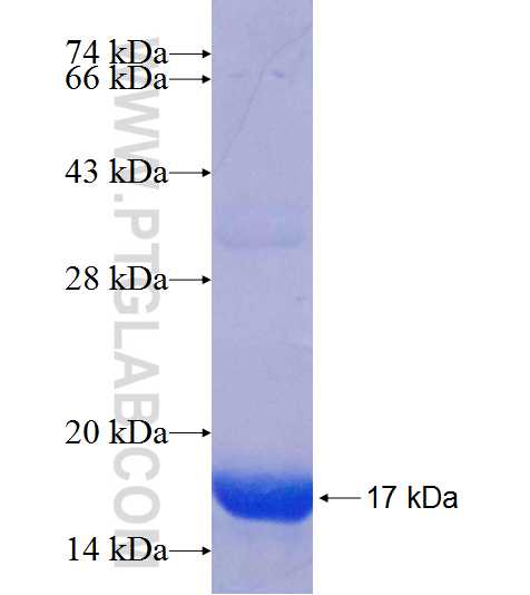 RBP1 fusion protein Ag18864 SDS-PAGE