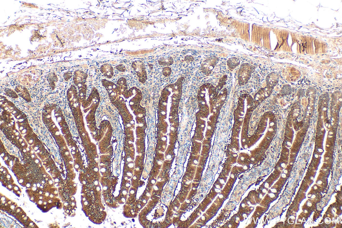 Immunohistochemistry (IHC) staining of human small intestine tissue using RBP2 Polyclonal antibody (31527-1-AP)