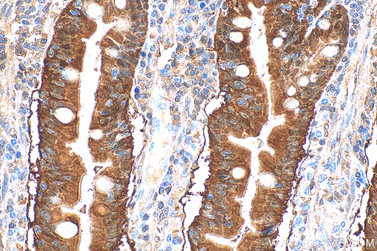 Immunohistochemistry (IHC) staining of human small intestine tissue using RBP2 Polyclonal antibody (31527-1-AP)