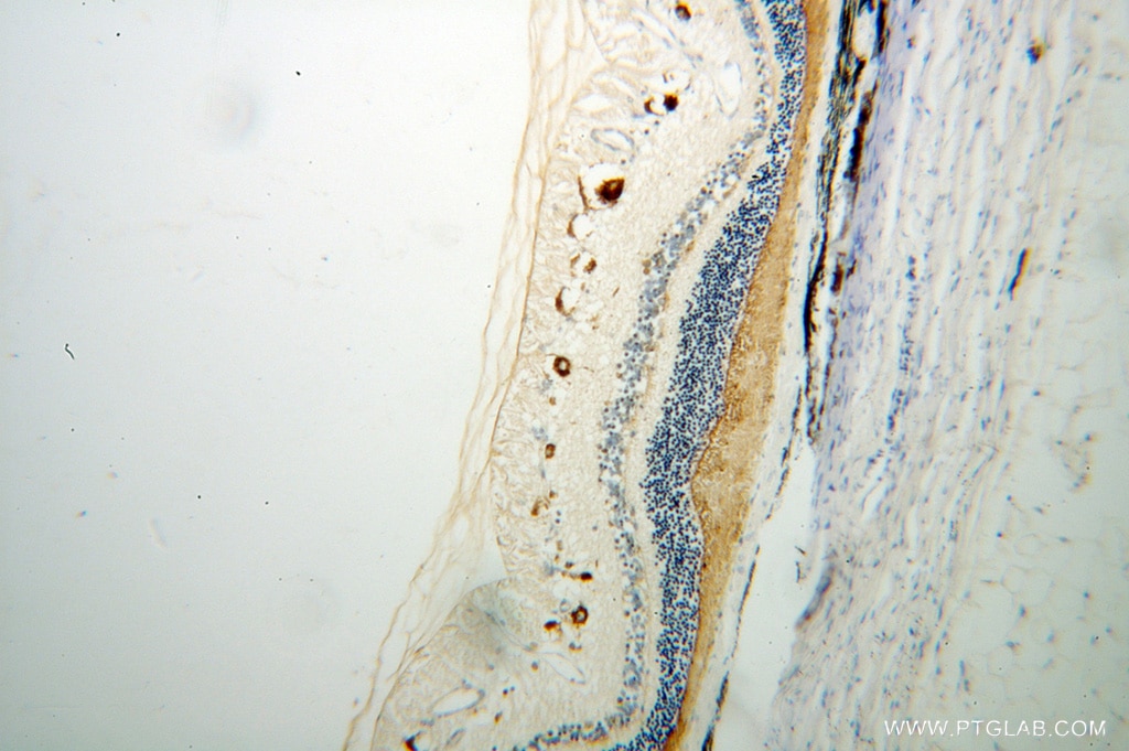 IHC staining of human eye using 14352-1-AP