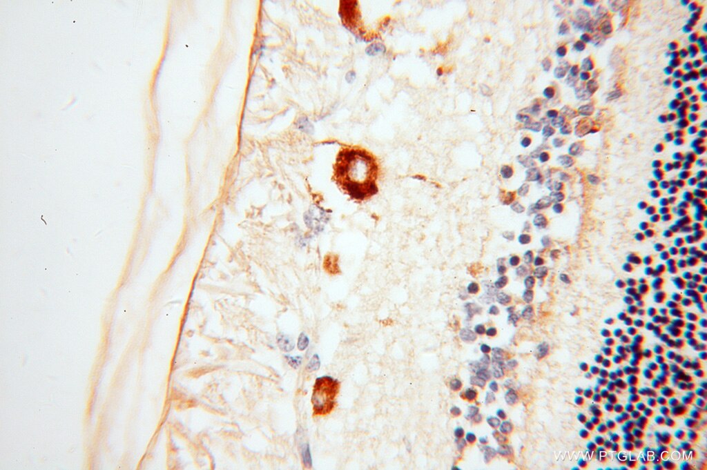 Immunohistochemistry (IHC) staining of human eye tissue using RBP3 Polyclonal antibody (14352-1-AP)