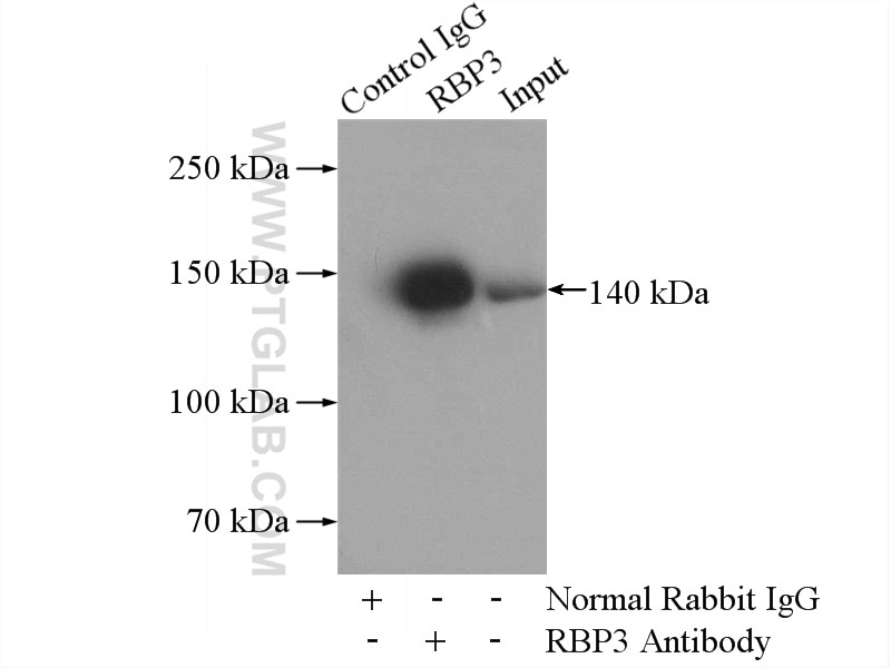 Immunoprecipitation (IP) experiment of Y79 cells using RBP3 Polyclonal antibody (14352-1-AP)