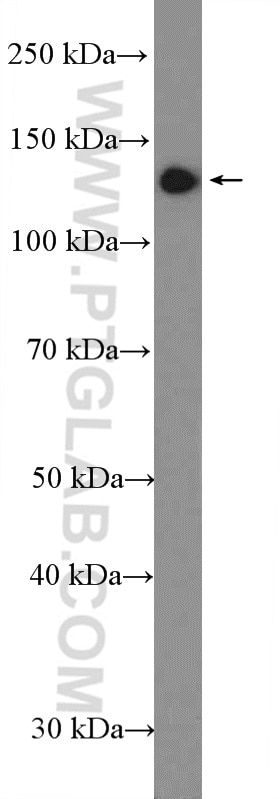 Western Blot (WB) analysis of Y79 cells using RBP3 Polyclonal antibody (14352-1-AP)