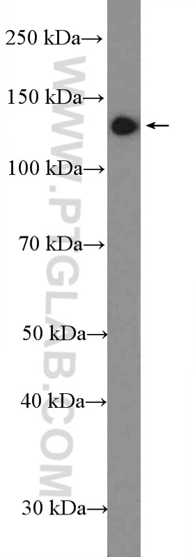 WB analysis of Y79 using 14352-1-AP