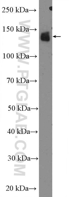 Western Blot (WB) analysis of mouse eye tissue using RBP3 Polyclonal antibody (14352-1-AP)