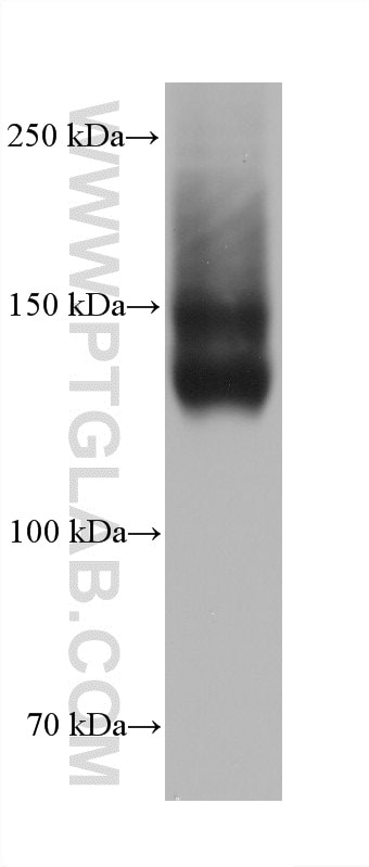 Western Blot (WB) analysis of rabbit retina tissue using RBP3 Monoclonal antibody (60921-3-Ig)