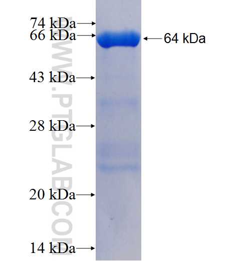 RBP3 fusion protein Ag5699 SDS-PAGE