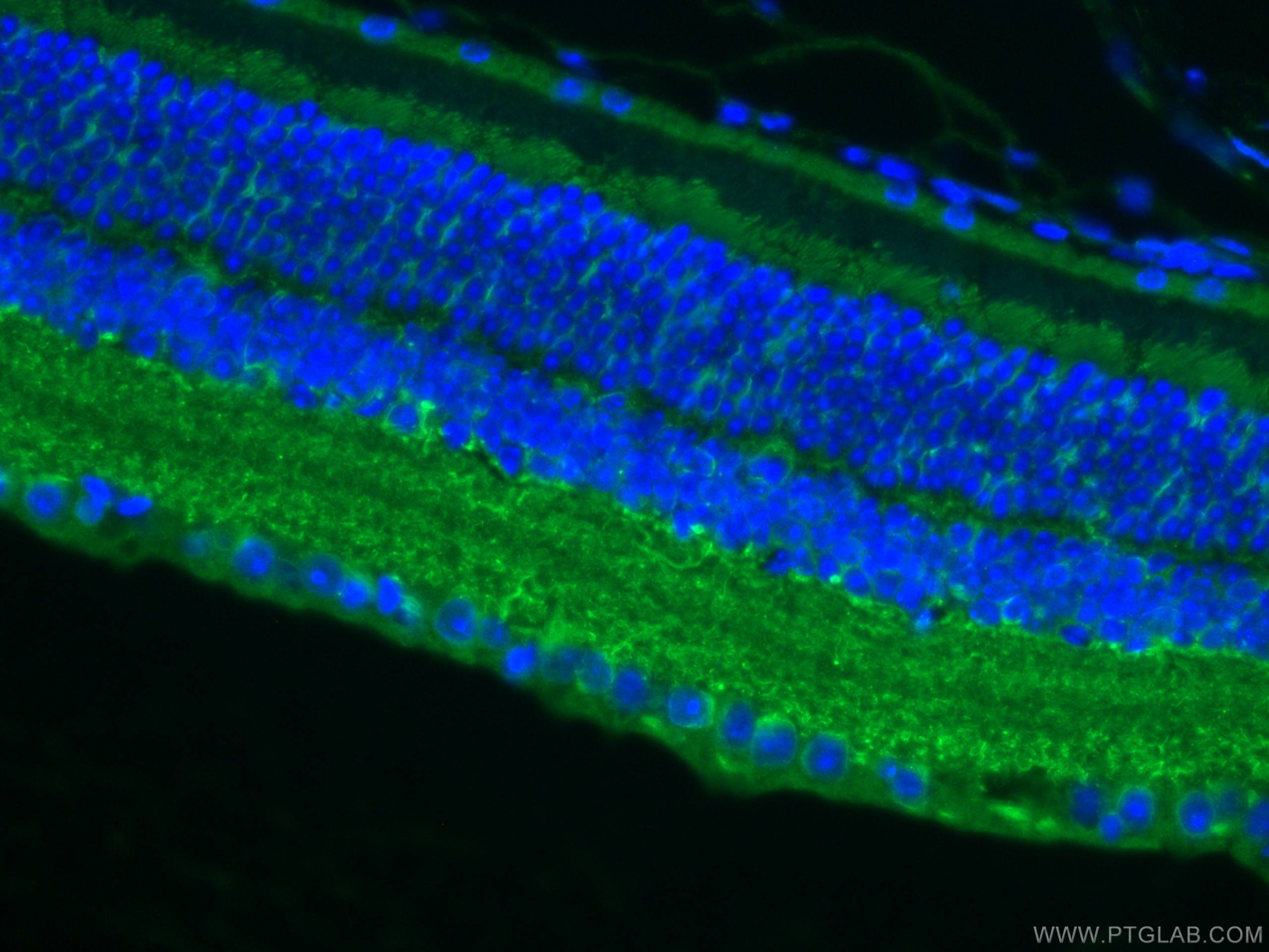 IF Staining of mouse eye using 11774-1-AP