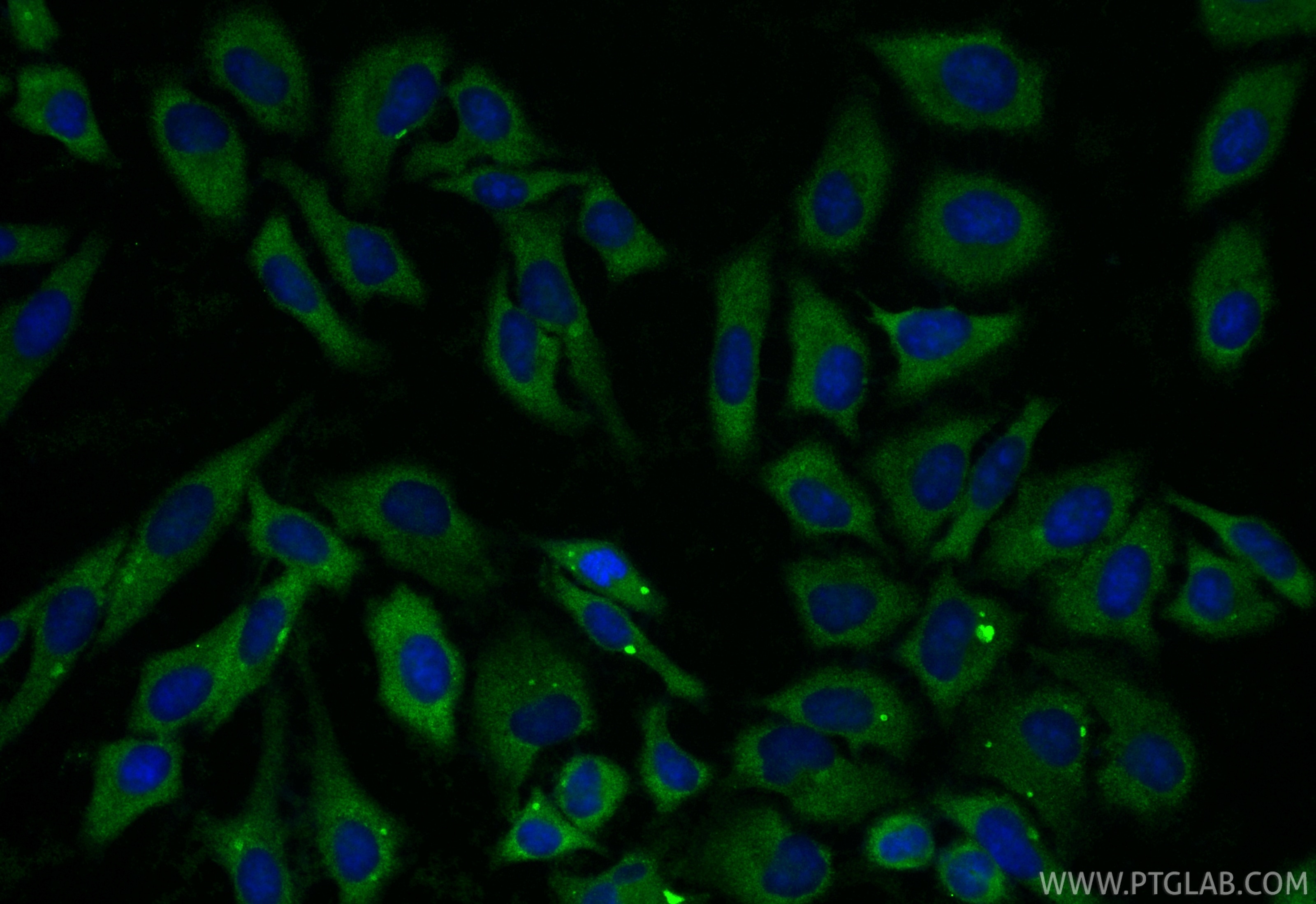 Immunofluorescent analysis of (-20°C Ethanol) fixed HepG2 cells using RBP4 antibody (11774-1-AP) at dilution of 1:375 and CoraLite®488-Conjugated Goat Anti-Rabbit IgG(H+L) (SA00013-2). Immunofluorescence (IF) / fluorescent staining of HepG2 cells using RBP4 Polyclonal antibody (11774-1-AP)