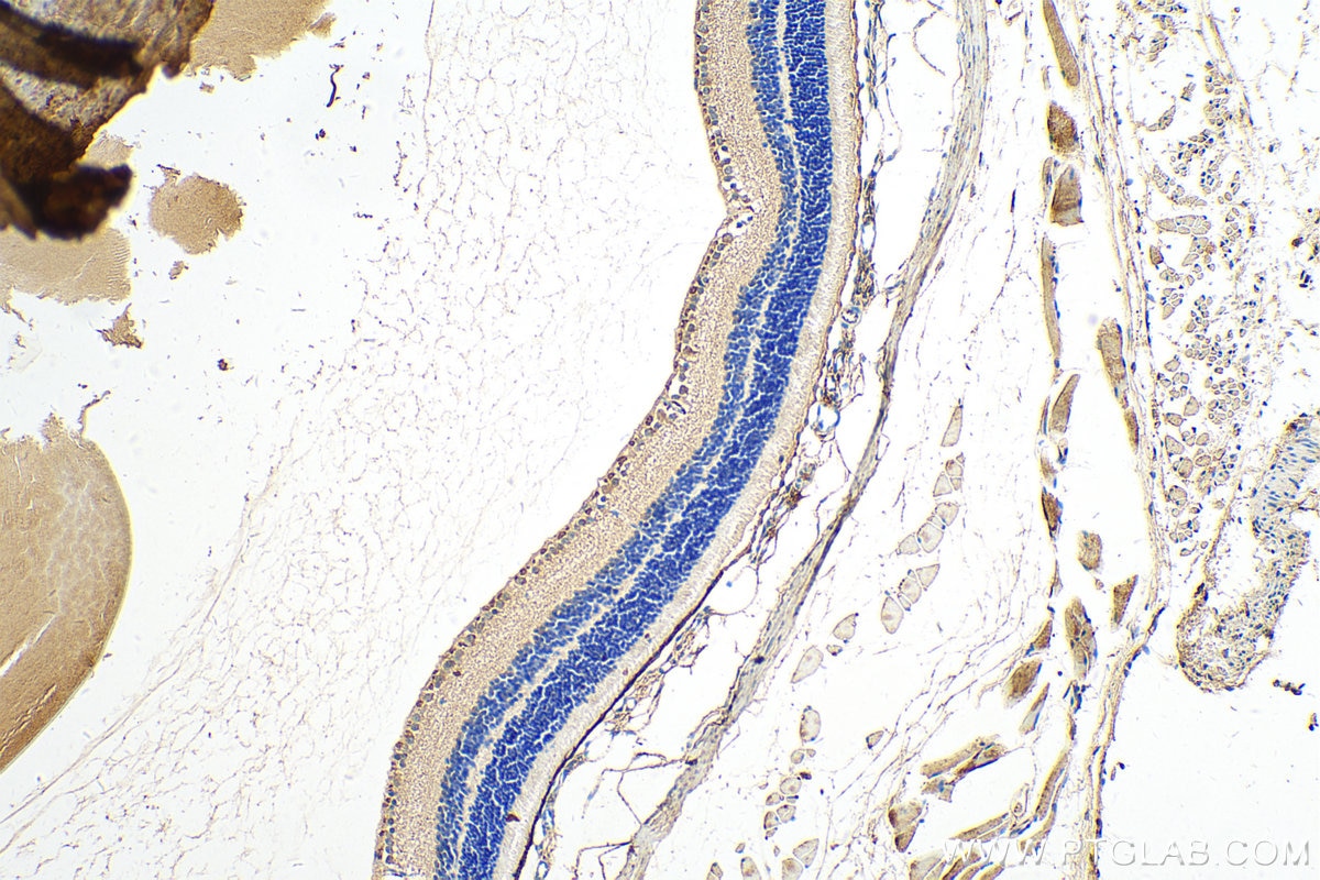 Immunohistochemistry (IHC) staining of mouse eye tissue using RBP4 Polyclonal antibody (11774-1-AP)