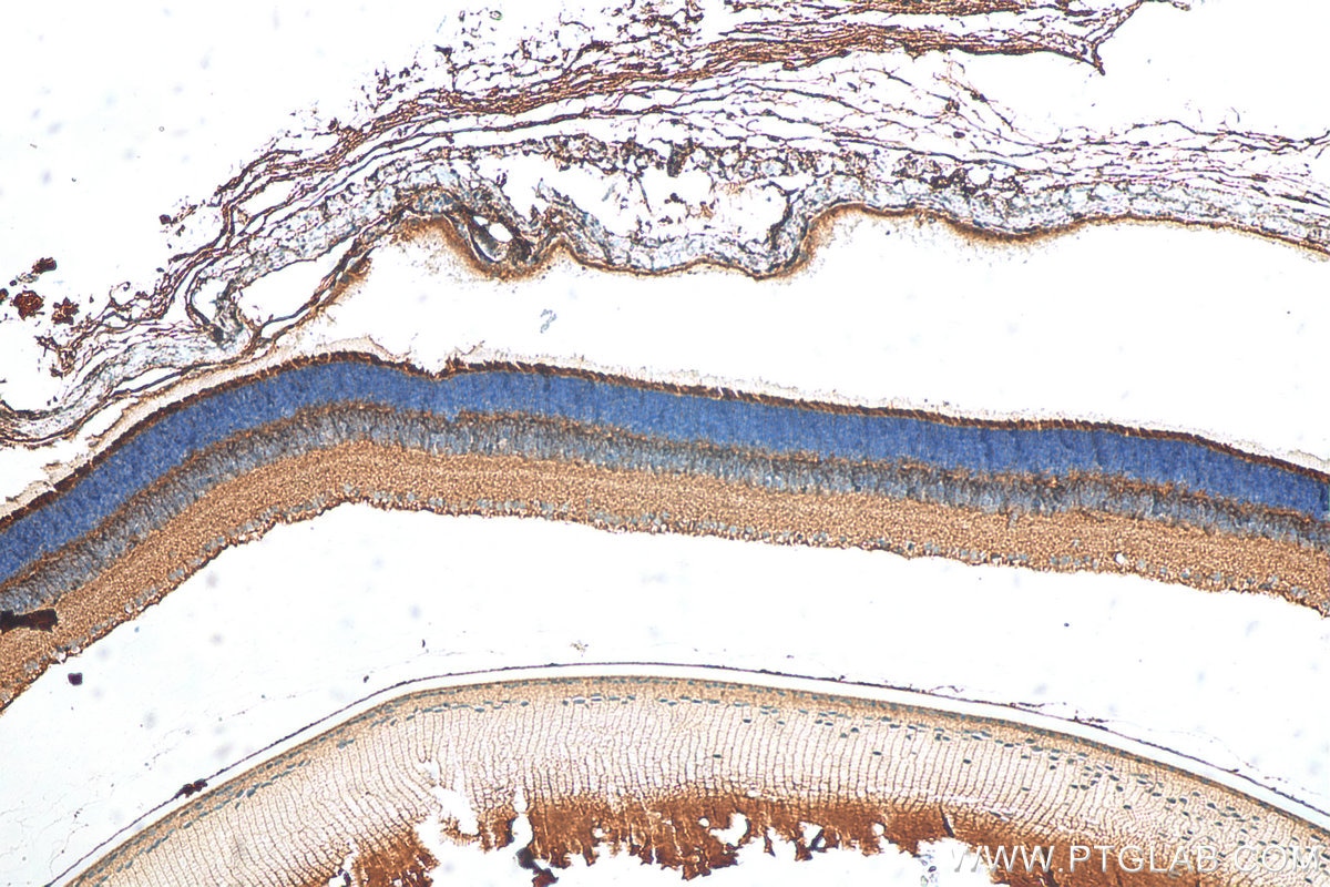 Immunohistochemistry (IHC) staining of mouse eye tissue using RBP4 Polyclonal antibody (11774-1-AP)