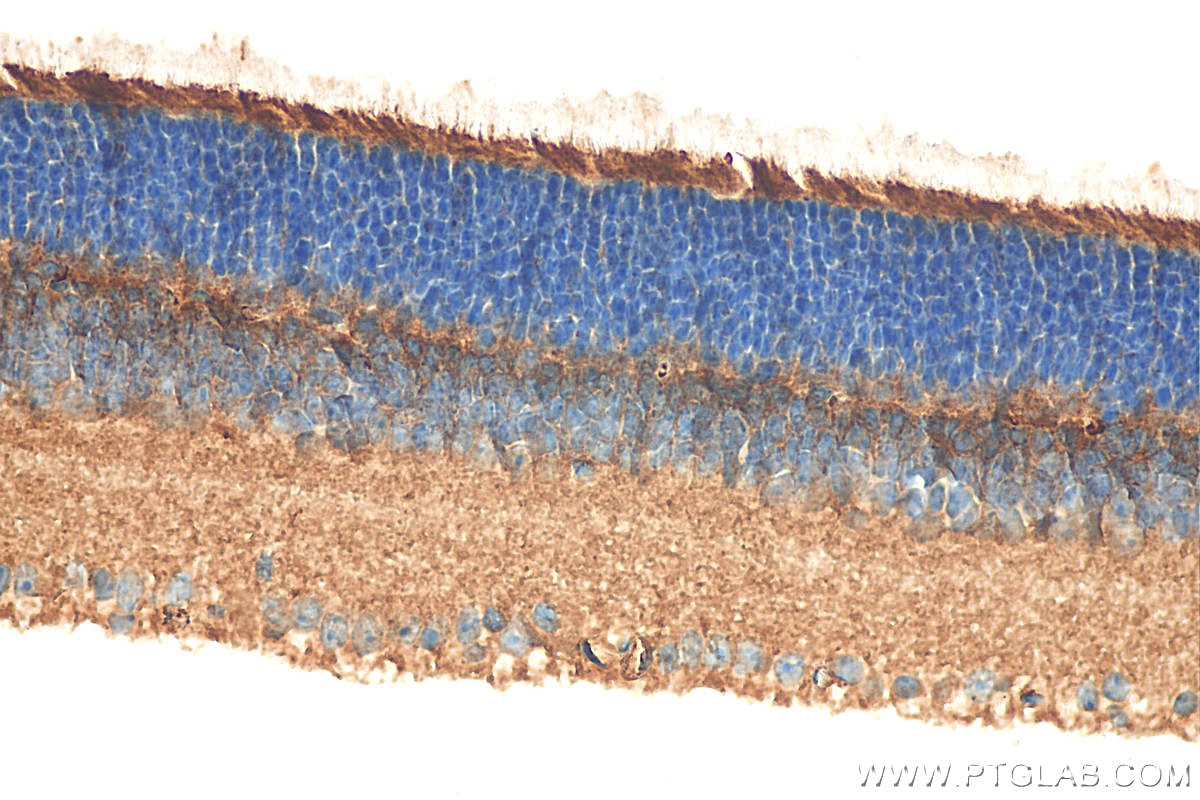 Immunohistochemistry (IHC) staining of mouse eye tissue using RBP4 Polyclonal antibody (11774-1-AP)