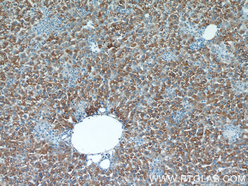 Immunohistochemistry (IHC) staining of mouse liver tissue using RBP4 Polyclonal antibody (11774-1-AP)