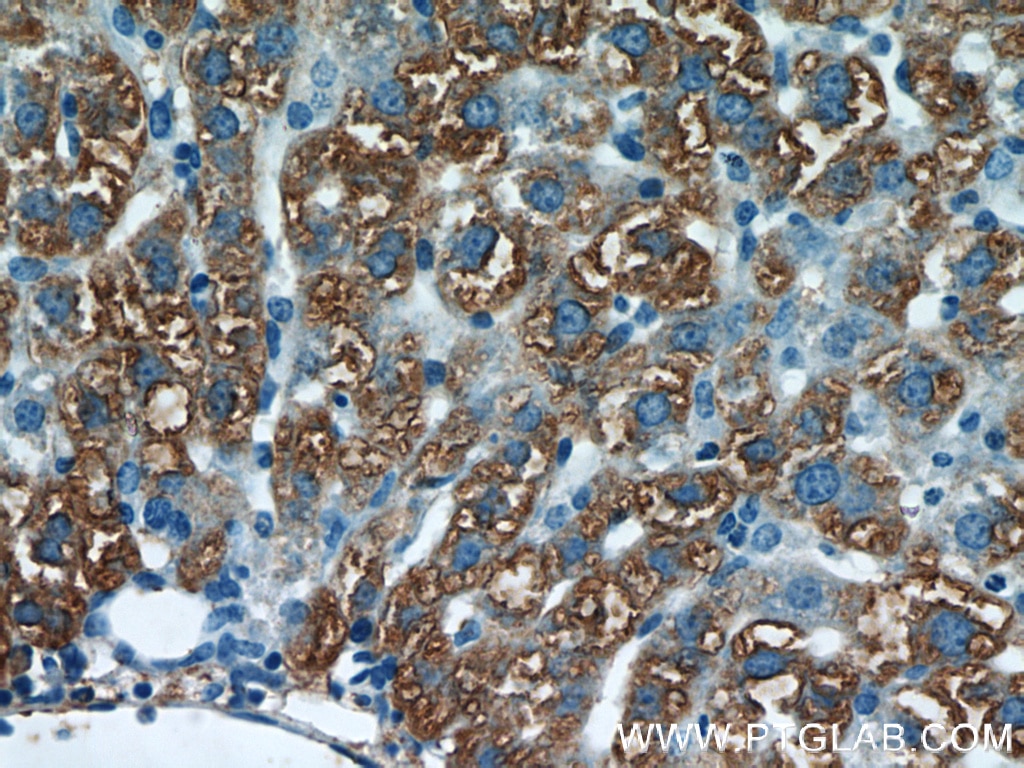 Immunohistochemistry (IHC) staining of mouse liver tissue using RBP4 Polyclonal antibody (11774-1-AP)