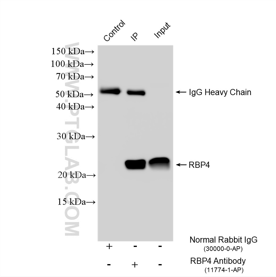Immunoprecipitation (IP) experiment of HepG2 cells using RBP4 Polyclonal antibody (11774-1-AP)
