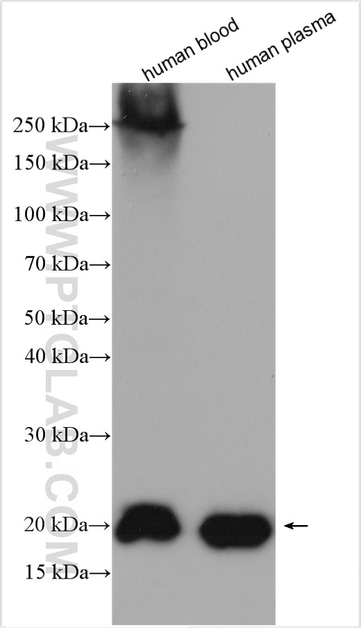 Western Blot (WB) analysis of various lysates using RBP4 Polyclonal antibody (11774-1-AP)