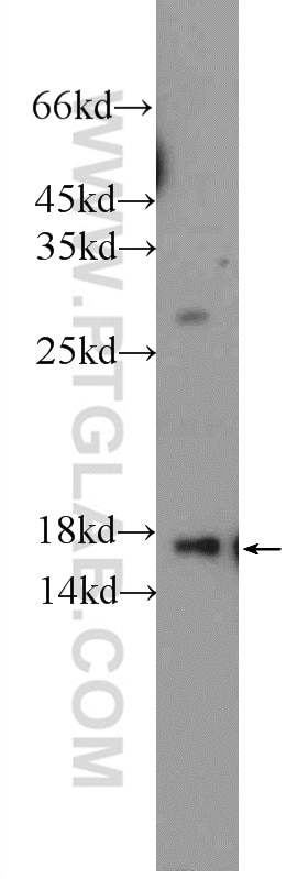 WB analysis of rat liver using 11774-1-AP