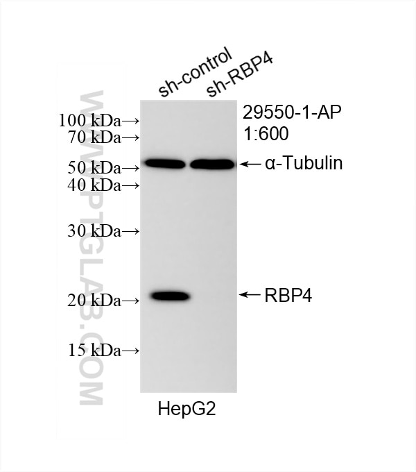 Western Blot (WB) analysis of HepG2 cells using RBP4 Polyclonal antibody (29550-1-AP)