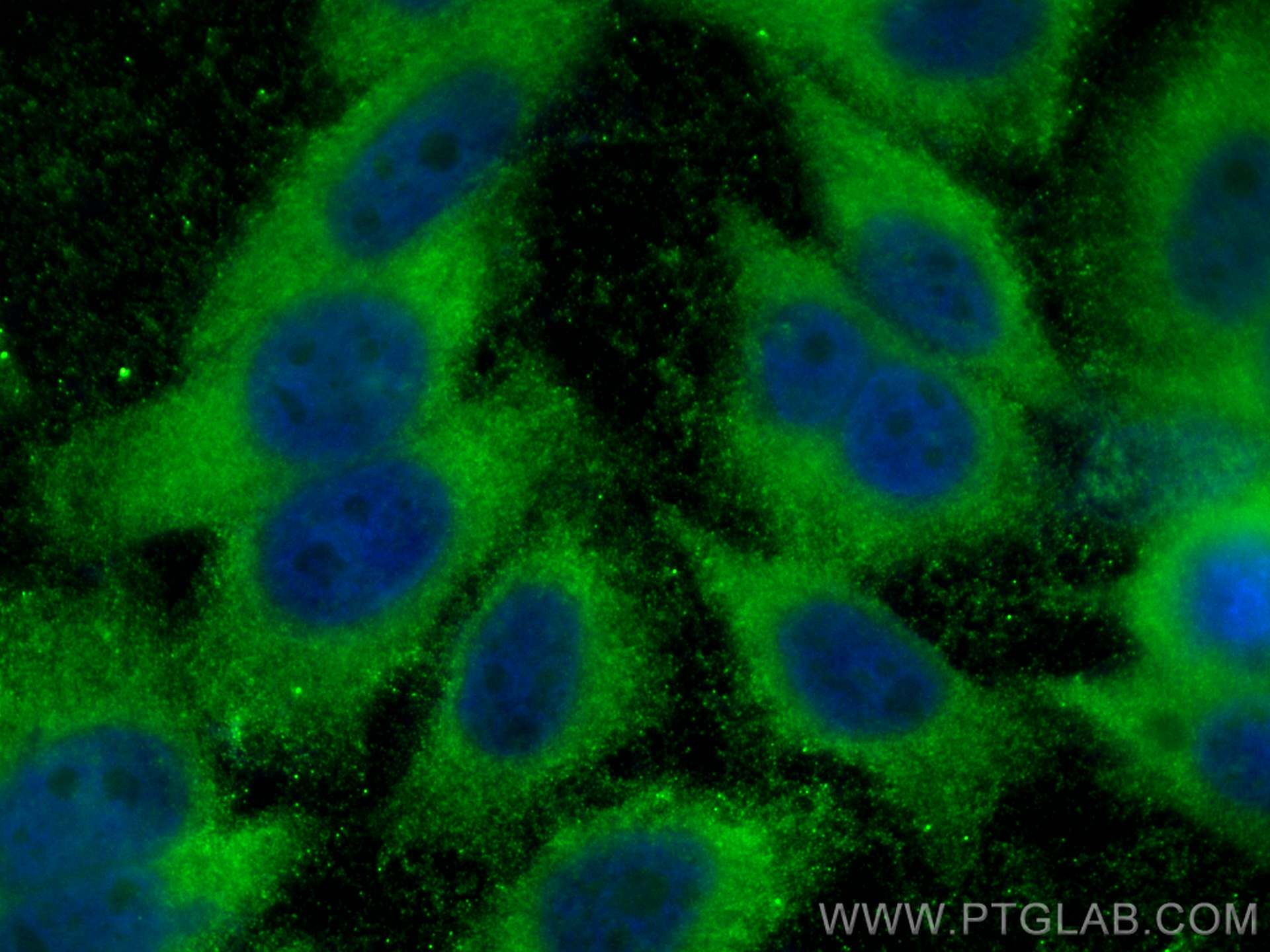 Immunofluorescence (IF) / fluorescent staining of HepG2 cells using RBP4 Monoclonal antibody (66104-1-Ig)