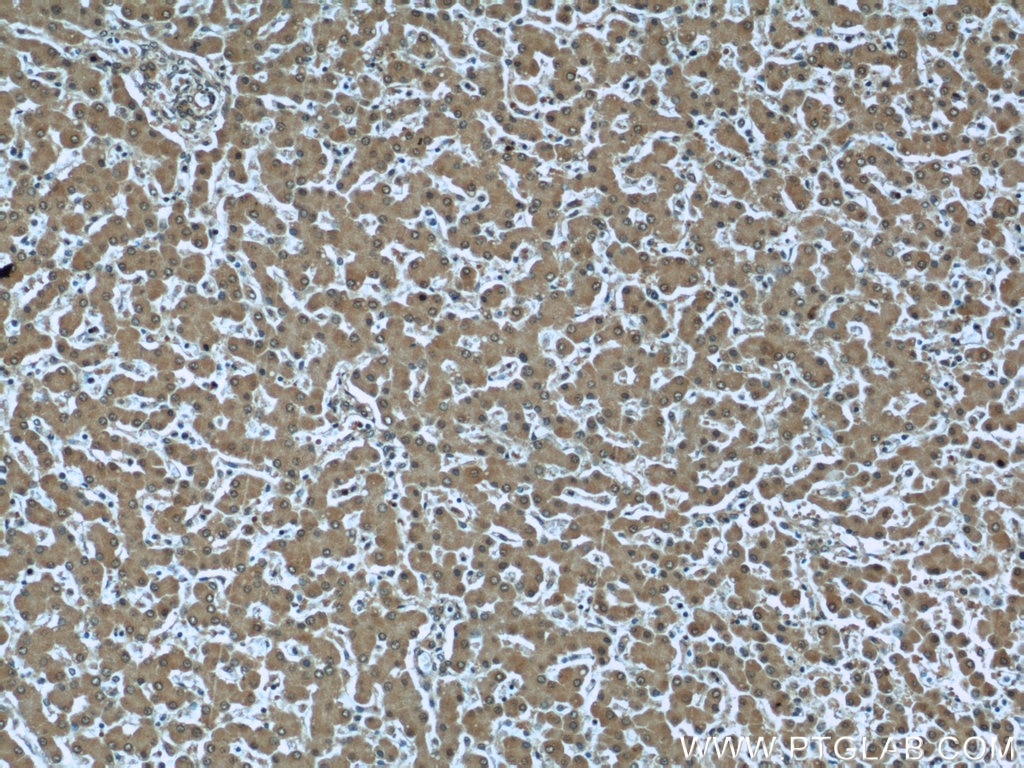Immunohistochemistry (IHC) staining of human liver tissue using RBP4 Monoclonal antibody (66104-1-Ig)
