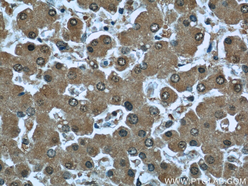 Immunohistochemistry (IHC) staining of human liver tissue using RBP4 Monoclonal antibody (66104-1-Ig)