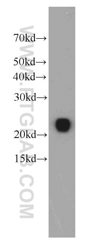 Western Blot (WB) analysis of human plasma using RBP4 Monoclonal antibody (66104-1-Ig)