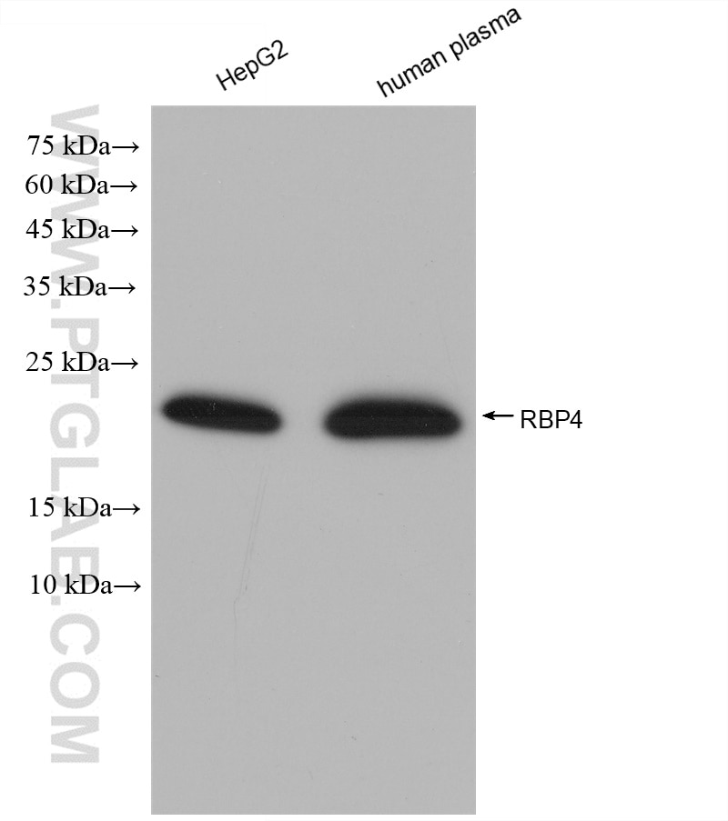 Western Blot (WB) analysis of various lysates using RBP4 Recombinant antibody (82934-1-RR)