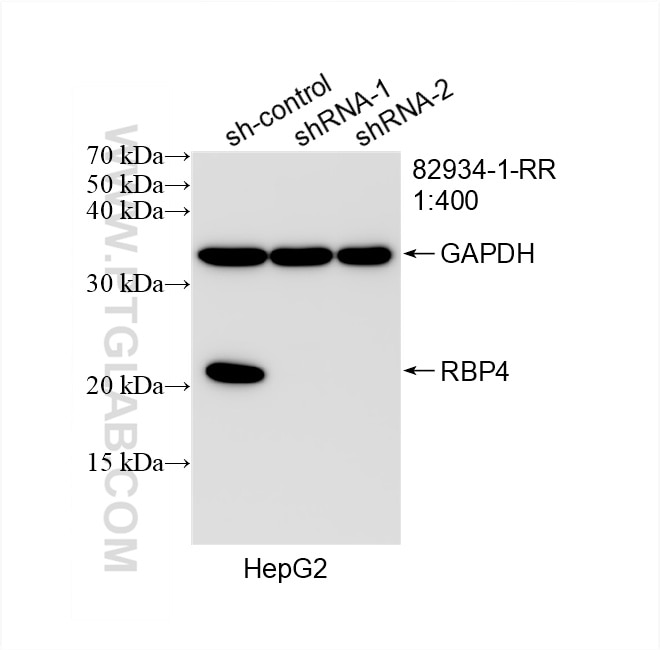 Western Blot (WB) analysis of HepG2 cells using RBP4 Recombinant antibody (82934-1-RR)