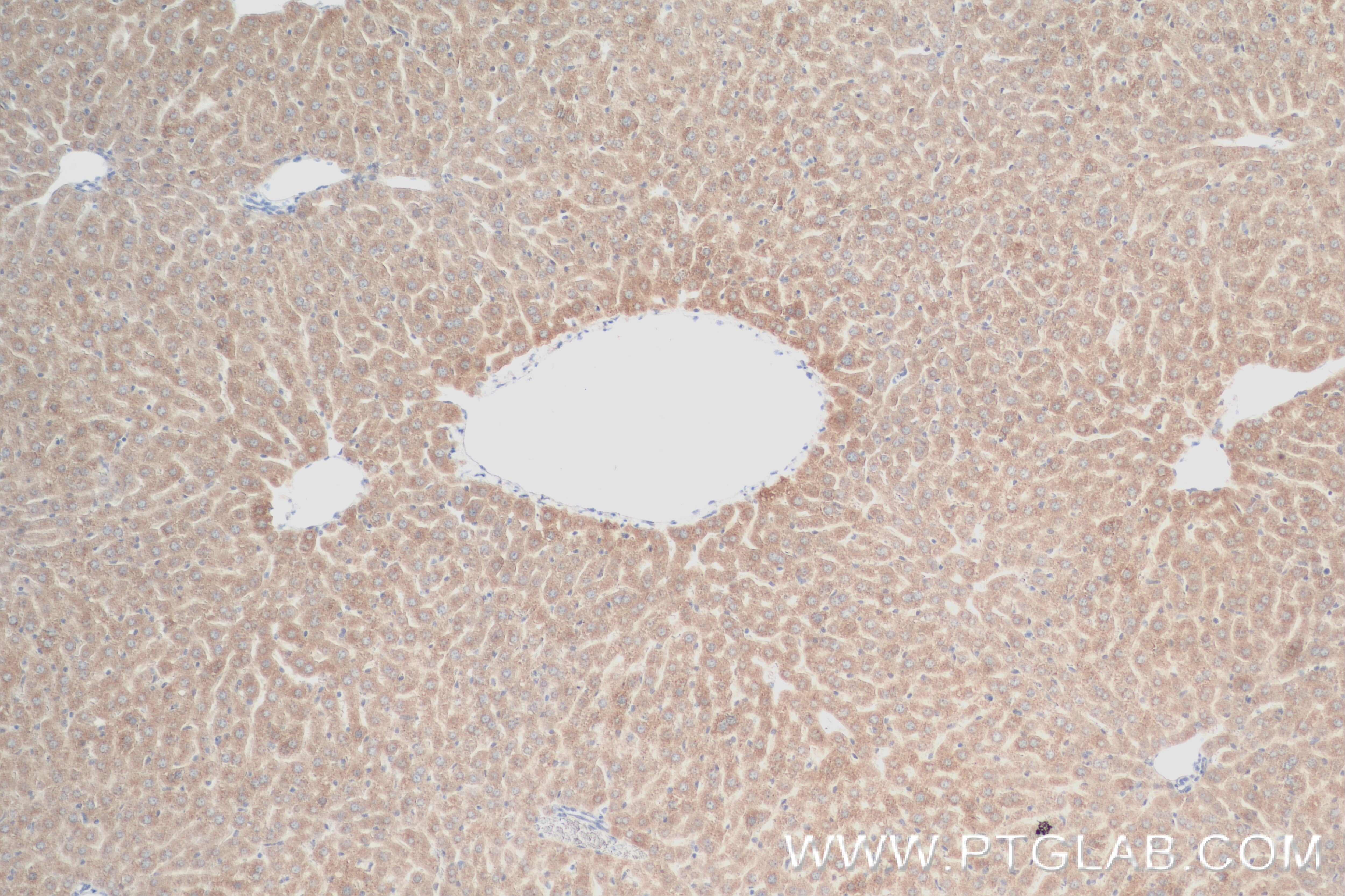 Immunohistochemistry (IHC) staining of mouse liver tissue using RBP4 Recombinant antibody (84503-4-RR)