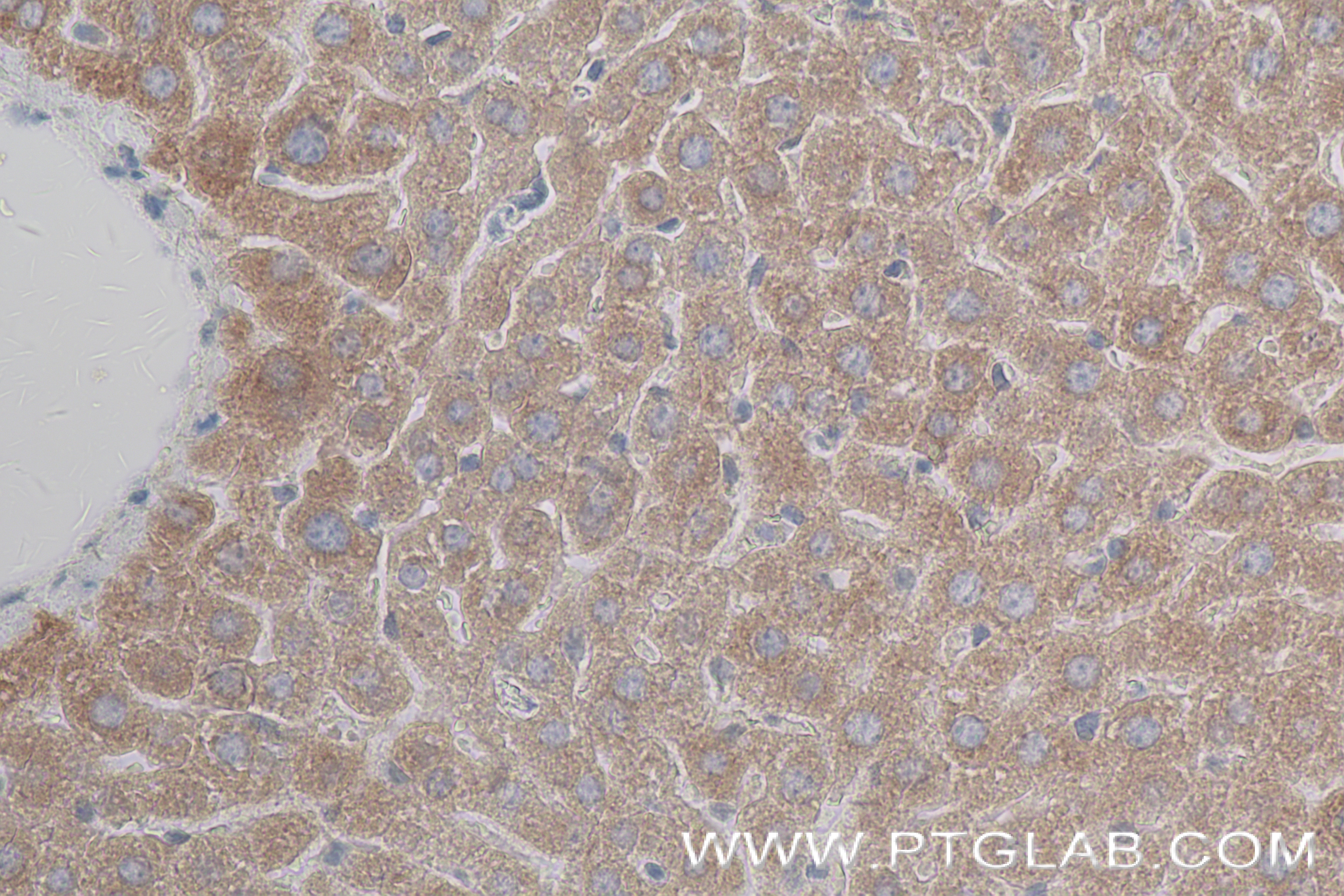 Immunohistochemistry (IHC) staining of mouse liver tissue using RBP4 Recombinant antibody (84503-4-RR)