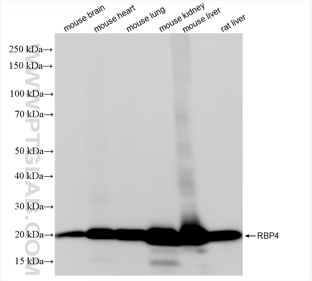Western Blot (WB) analysis of various lysates using RBP4 Recombinant antibody (84503-4-RR)