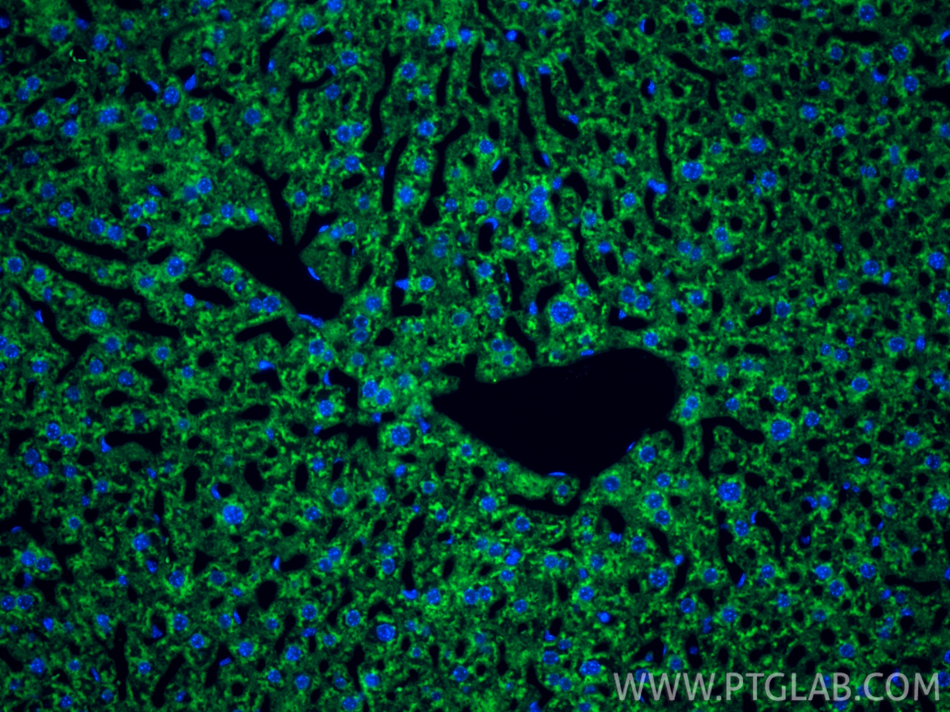Immunofluorescent analysis of (4% PFA) fixed paraffin-embedded mouse liver tissue using CoraLite® Plus 488 RBP4 antibody (CL488-84503-4, Clone: 242040D6 ) at dilution of 1:200. Heat mediated antigen retrieval with Tris-EDTA buffer (pH 9.0). Immunofluorescence (IF) / fluorescent staining of mouse liver tissue using CoraLite® Plus 488-conjugated RBP4 Recombinant mon (CL488-84503-4)