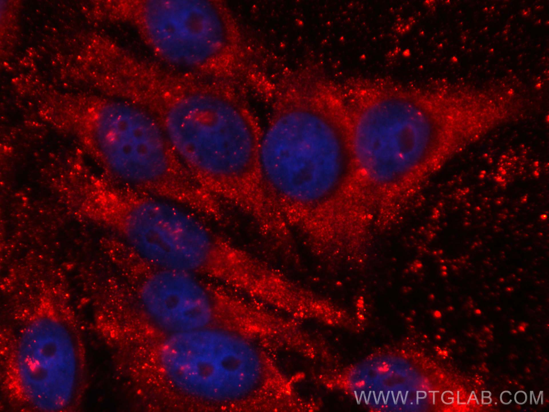 Immunofluorescence (IF) / fluorescent staining of HepG2 cells using CoraLite®594-conjugated RBP4 Monoclonal antibody (CL594-66104)