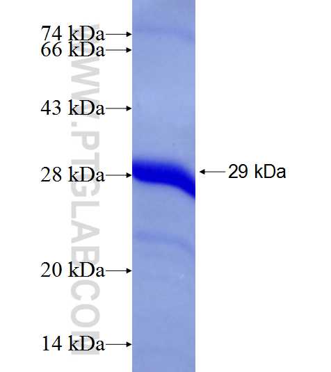 RBP4 fusion protein Ag19295 SDS-PAGE