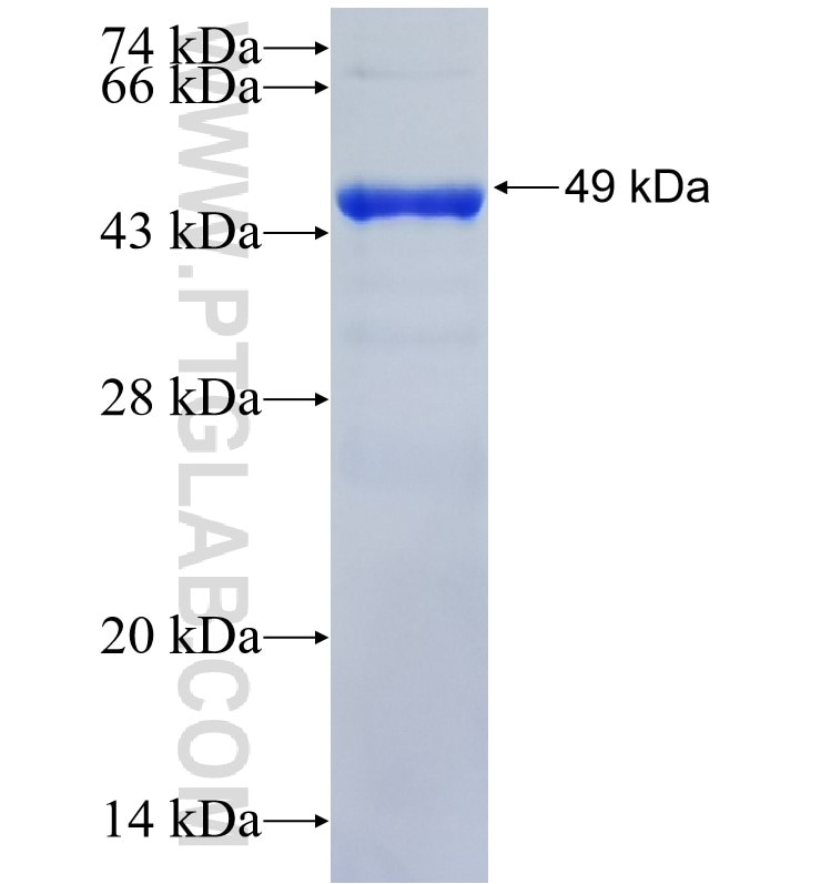 RBP4 fusion protein Ag2448 SDS-PAGE