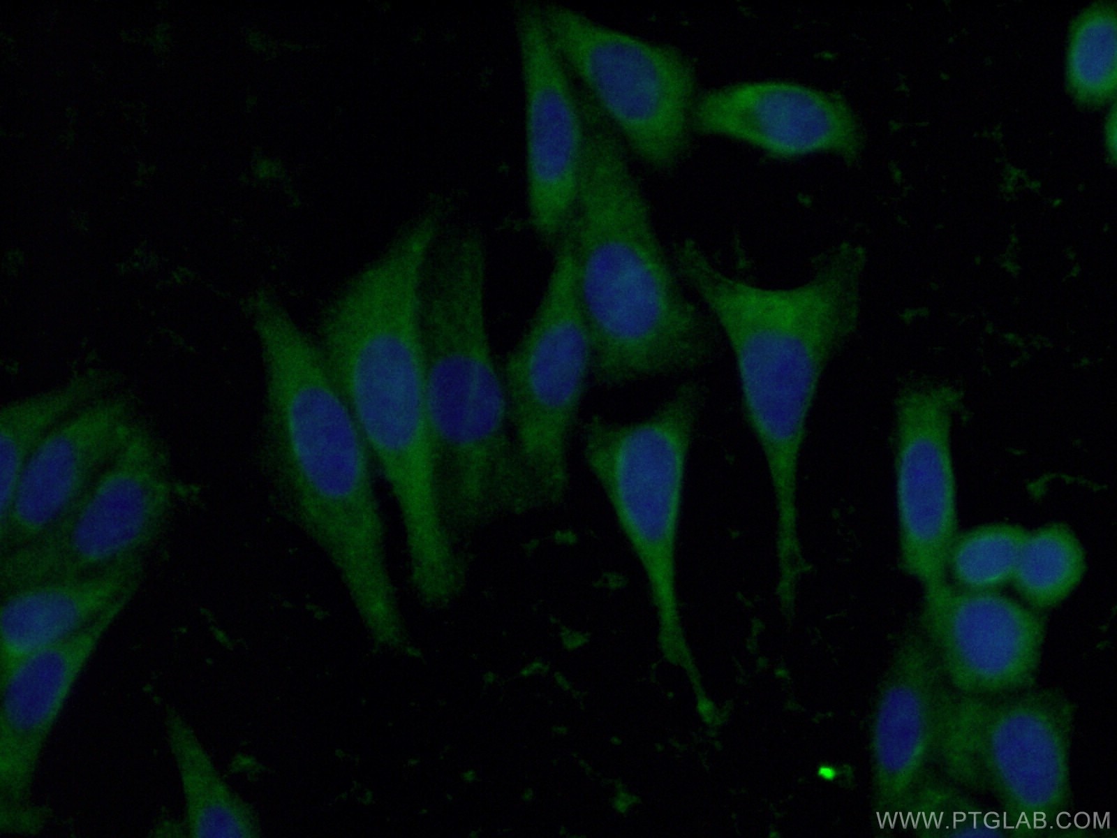 Immunofluorescence (IF) / fluorescent staining of HepG2 cells using RBP5 Polyclonal antibody (11843-1-AP)