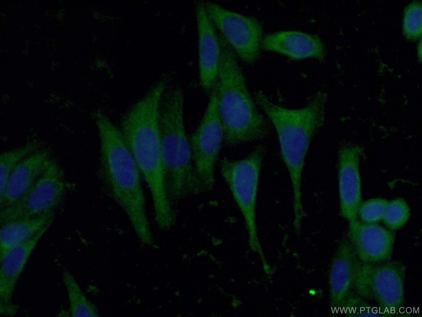 IF Staining of HepG2 using 11843-1-AP