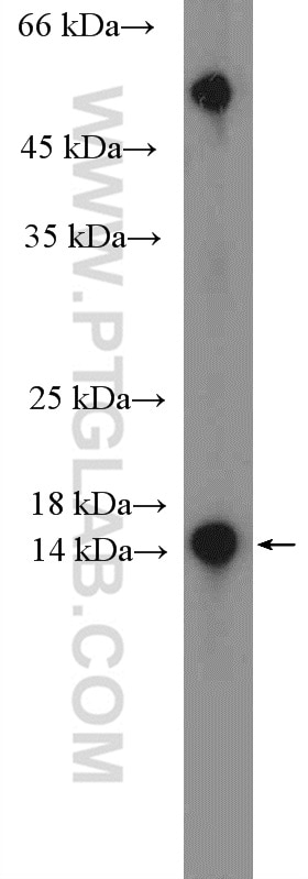 Western Blot (WB) analysis of pig liver tissue using RBP5 Polyclonal antibody (11843-1-AP)