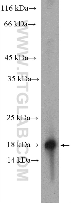 Western Blot (WB) analysis of rat liver tissue using RBP5 Polyclonal antibody (11843-1-AP)