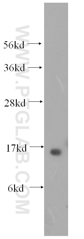 Western Blot (WB) analysis of human liver tissue using RBP5 Polyclonal antibody (11843-1-AP)