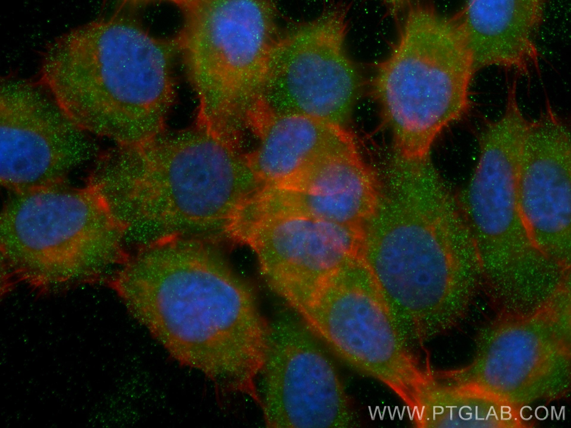 Immunofluorescence (IF) / fluorescent staining of A431 cells using RBP5 Monoclonal antibody (68126-1-Ig)
