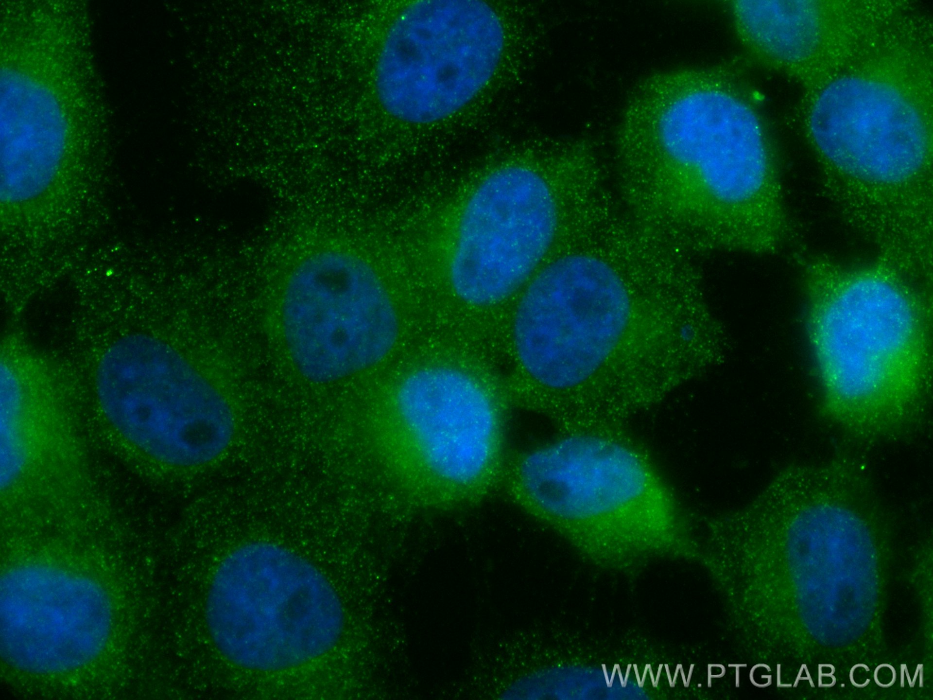 Immunofluorescence (IF) / fluorescent staining of A431 cells using CoraLite® Plus 488-conjugated RBP5 Monoclonal anti (CL488-68126)