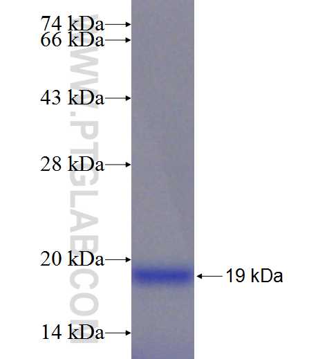 RBP5 fusion protein Ag24562 SDS-PAGE