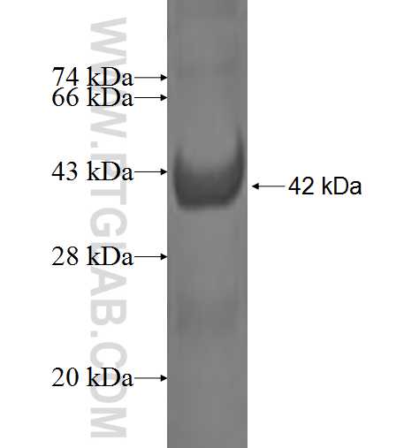 RBP5 fusion protein Ag2485 SDS-PAGE