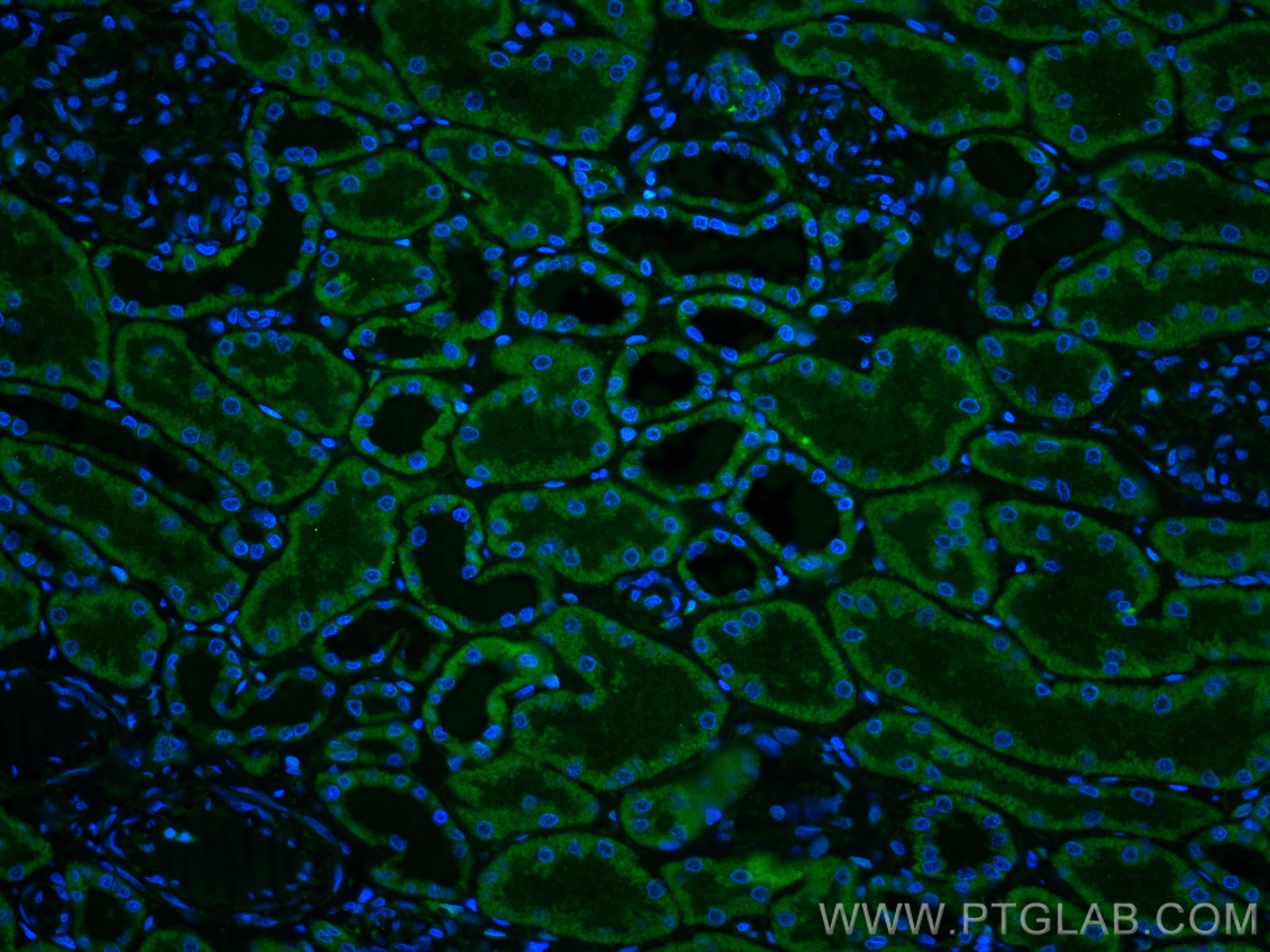 Immunofluorescence (IF) / fluorescent staining of human kidney tissue using RBP7 Polyclonal antibody (14541-1-AP)