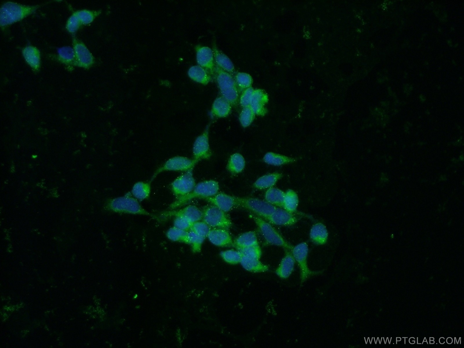 Immunofluorescence (IF) / fluorescent staining of HEK-293 cells using RBP7 Polyclonal antibody (14541-1-AP)