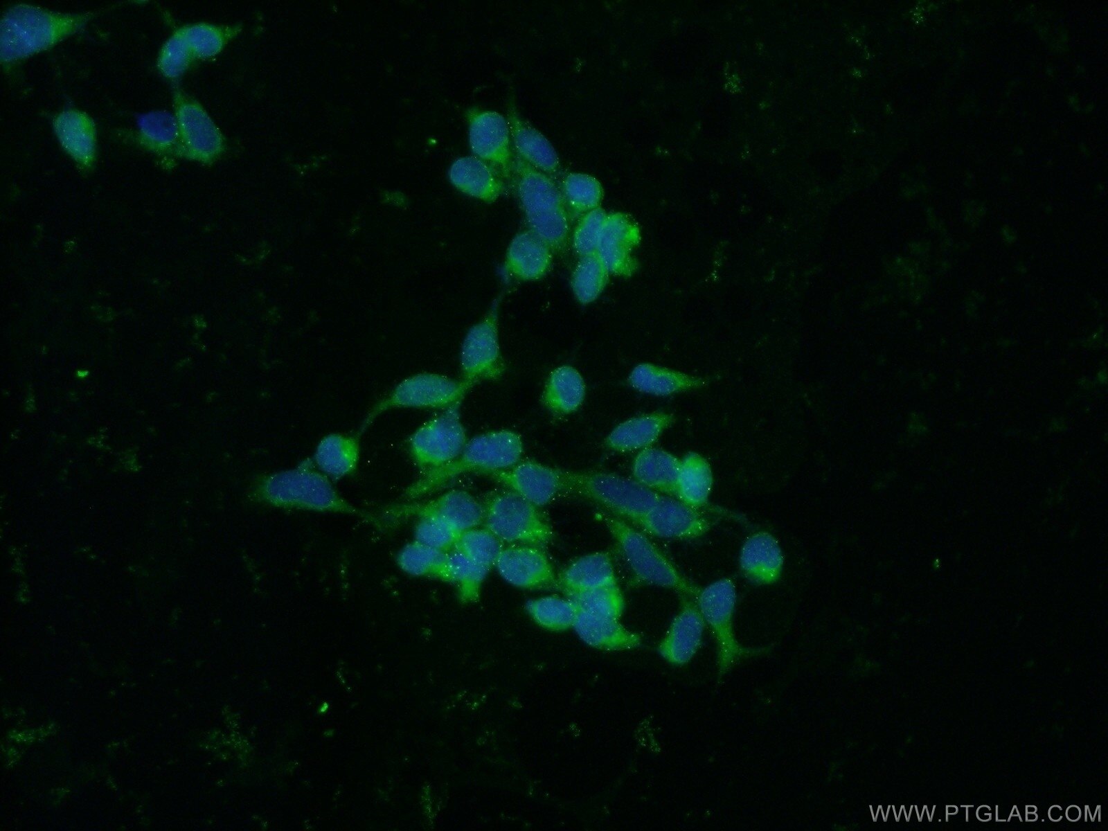 IF Staining of HEK-293 using 14541-1-AP